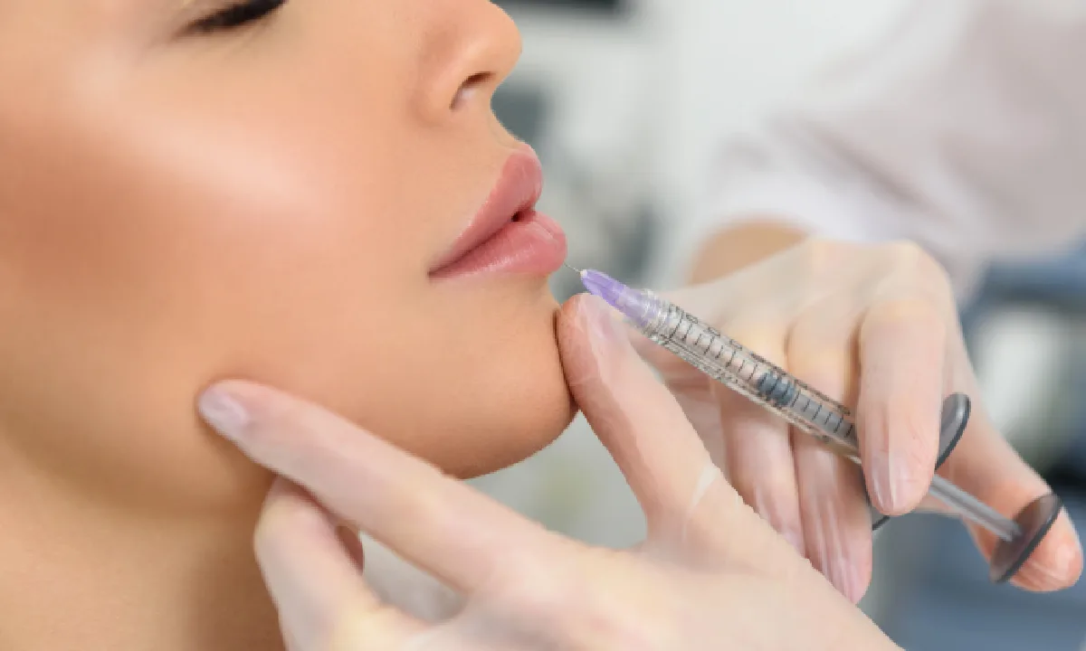 Lip filler for balanced lips