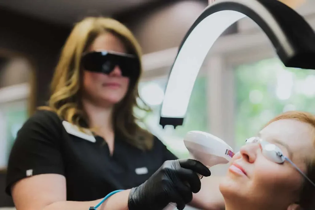 IPL Pigment Reduction