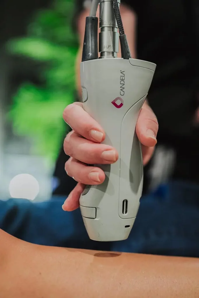 Laser Treatments Education | Expert Insights & Tips