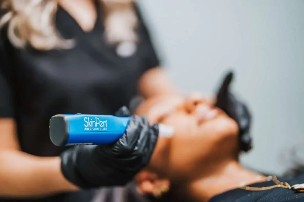 SkinPen Microneedling in Savannah, GA | Altera Aesthetix